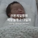 산본2 | 산본제일병원 제왕절개 2~3일차 후기 : 1인실 이동, 신생아실 면회, 젖몸살 예방팁