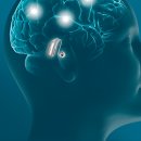 오티콘 보청기 이미지