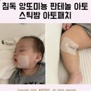 아토건 | 침독 앙또미뇽 판테놀 아토 스틱밤 아토패치 솔직후기