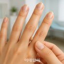 와치 이미지