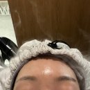 웰킨두피탈모센터 하남미사점에서 파워스케일링 받은 후기 무료진단+첫 케어 50%할인