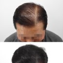 리게인프로젝트 부산점 이미지