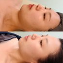 희망의 꿈 | 해운대 피부관리 마린시티 윤곽관리 광안리 예신관리 에스테티아