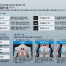 하나의료기 이미지