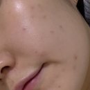 인터넷 기초 | 올리브영 클렌징/기초제품 추천템 (수부지,트러블 피부 정착 후기)