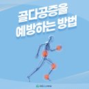 골다공증 예방하는 방법이 궁금하다면? 이미지