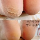 천안청수동 문제성 손발 관리 전문숍 ‘수지네일&#39;