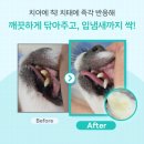 바로덴탈 네이버블로그