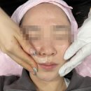 영등포피부관리 나비네일에서 재생관리 했어요