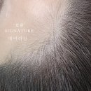 체인지헤어라인