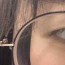 다함약국 | 렌즈삽입술 수술 후기 (2024년 3월) + 2년 후 정기검진