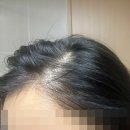 모스칼프 이미지