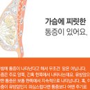 유방통증과 달맞이꽃종자유 효능 이미지