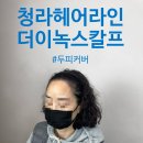 청라 헤어라인 자연스러운 두피 커버 &#39;더이녹스칼프&#39;