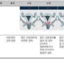 자궁암 초기 효능 및 증상 원인 이미지