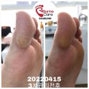 정관동일3차남자경로당 | 부산해운대남자발바닥굳은살관리후기