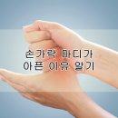 손가락 마디가 아픈 이유 알기 이미지