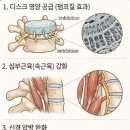 척추 경추에 도움 되는 운동 이미지