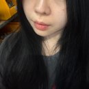 톤앤업피부과의원 | 티타늄리프팅(듀얼티타늄) 내돈내산 예신관리 후기