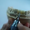 네오치과기공소 이미지