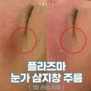 더맑은스킨(매곡점)