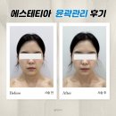현아에스테틱 | 대전 에스테틱 둔산동 신부관리 웨딩케어 윤곽관리 에스테티아 대전타임월드점에서 갸름한 얼굴라인 만들기