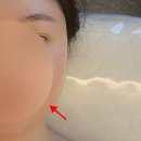 상남동 피부관리샵 가성비 좋은 특수 관리 올오브뷰티