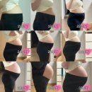 11260-1-18-37 | 출산 이야기 - 37주 제왕절개 후기 by 대학병원