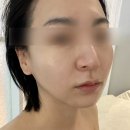오산 피부관리 강력추천 : 수담