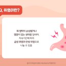 윗배의 통증 의심할 질환은 무엇일까 헛구역질복부 팽만감소화불량이라면 이미지