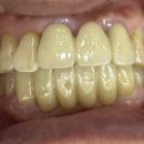 삼화치과기공소 이미지