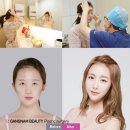 강남더뷰티성형외과 네이버블로그
