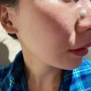 (주)오래온라이프사이언스 | 파이라이프사이언스 윙코 비강확장기, 코막힘 방지에 도움된 사용 후기