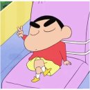 압구정 사이성형외과 뒤밑트임 수술전, 한달차, 3개월차 후기