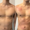 태크니끄 해운대 셀핏 프리미엄 | 해운대피부관리 태크니끄 해운대 셀핏 프리미엄 후기