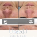 유니드케어 이미지