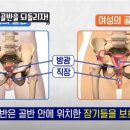 복부 아래쪽부터 꼬리뼈 위치까지 아픈 곳이 있는데 병원에 가서 검사해도 아무것도 나오지 않거나 혹은 생리불순 생리통이 있다면 한번 봐봐 이미지