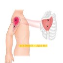 경혈 - 어깨통증(오십견과 회전근개염) 이미지