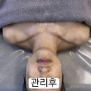 선 에스테딕 네이버블로그