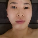 끌레르보떼에스테틱 | [여의도 피부관리 에스테틱] 끌레르보떼 달팡 윤곽관리 솔직후기
