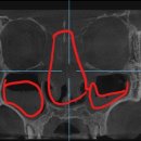 송도탑이비인후과의원 이미지