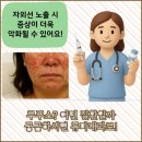 류마본내과의원 | 부산 금정구 류마내과 의원에서 알려드리는 자가면역질환과 관절 통증의 특징