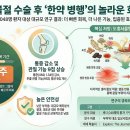 한약 병행, 경비골 골절 회복 단축 가능성... SCI(E) 논문 게재 이미지
