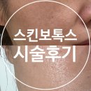 담티역 엘리베이터 뒤(2, 3번 출구 사이) | 강남구청역피부과 솔린의원, 스킨보톡스 시술 내돈내산 후기, 여름철 도드라지는 모공 관리