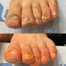 산본퀸네일