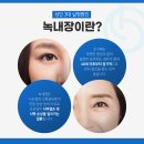 맑은안과 이미지