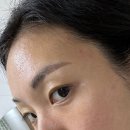 이룸메디칼 | 청주 피부관리실 <이룸에스테틱> LDM 수분관리 1번으로 이렇게 달라진다고요?