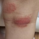 이봉구피부과의원 이미지