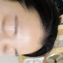 선헤어라인 | 부천헤어라인왁싱 선래쉬&amp;선왁싱 가격 주기 후기
