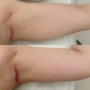 주바에스테틱 | 청주슬리밍, 바본관리는 가경동 정담에스테틱 후기